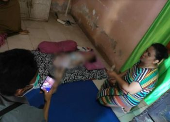 Apresiasi Wagub, KPAI Minta Pemkot Makassar Tangani Gadis 18 Tahun yang Tergolek Lemas